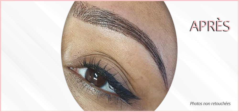 microblading après