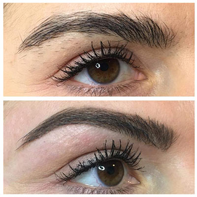 Restructuration de sourcils 49