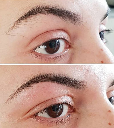 Restructuration des sourcils 49 Angers