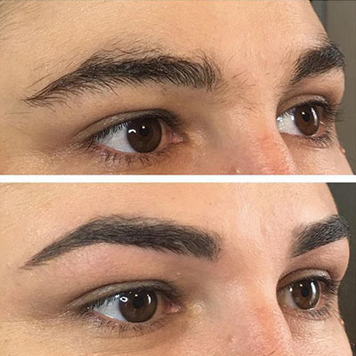 Restructuration des sourcils