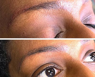Microblading après une dépigmentation 49