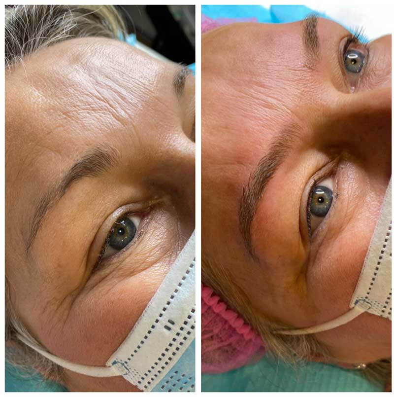 avant après maquillage semi-permament des sourcils salin à Angers 49