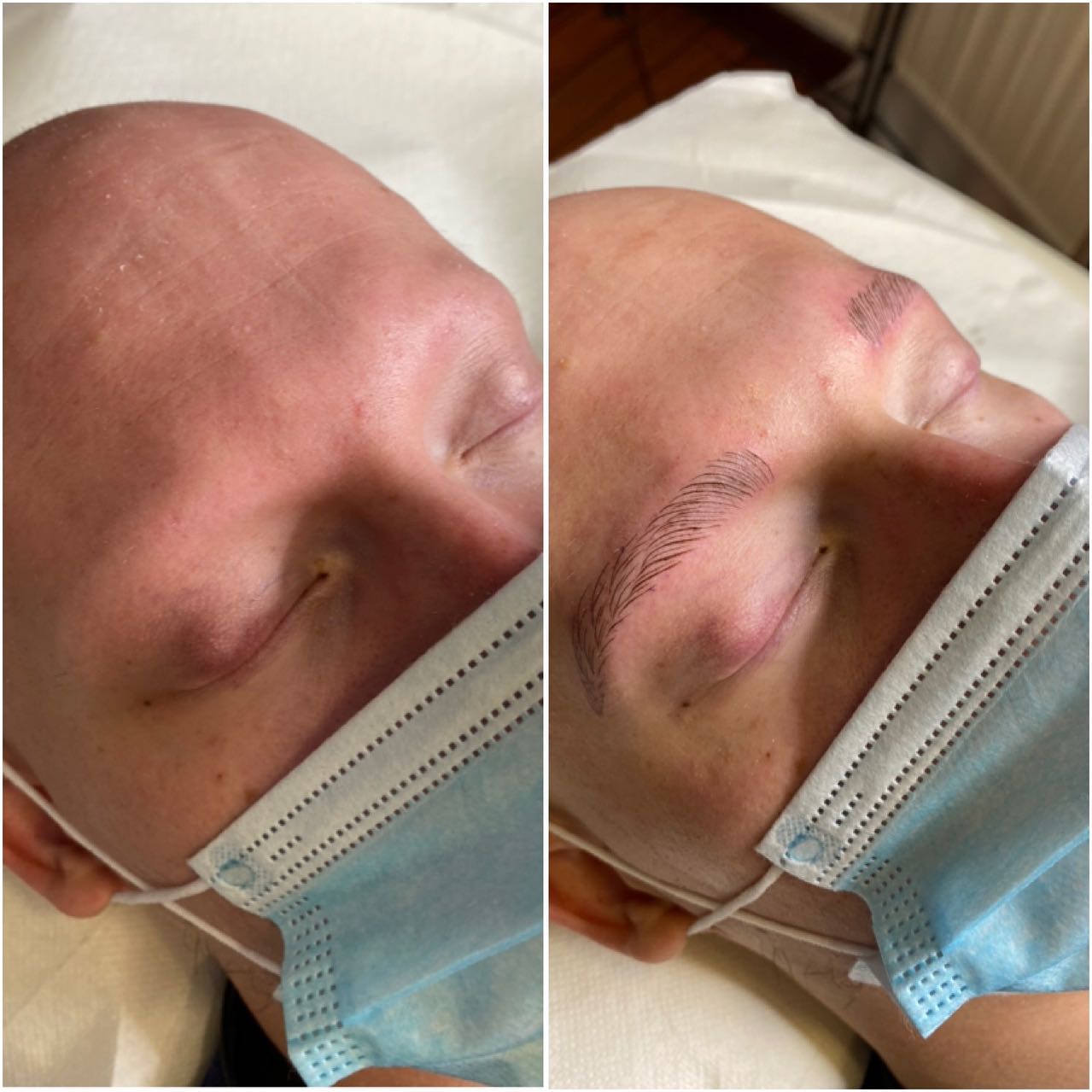 microblading homme perte des sourcils