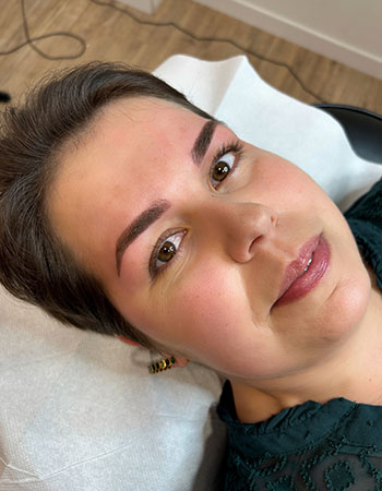 Shading à Angers 49