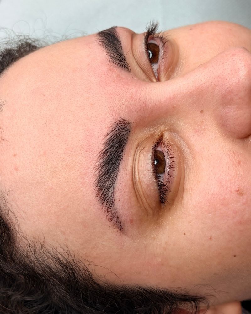 sourcils-brow-lift-angers-49 institu Brow Lift Angers 49